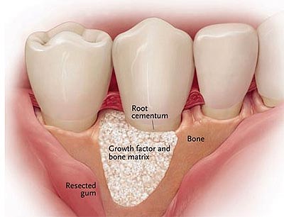 regenerative-dental-surgery