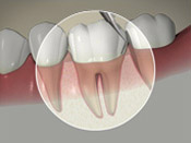 South Calgary Periodontal Group - Regular Dental Visits